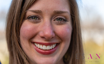 ¿Brackets linguales o Invisalign? Pros y contras de cada uno