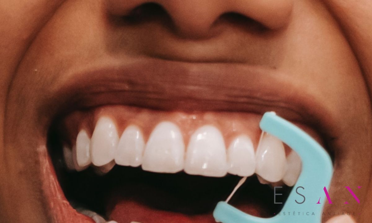 como_cuidar_los_implantes_dentales_
