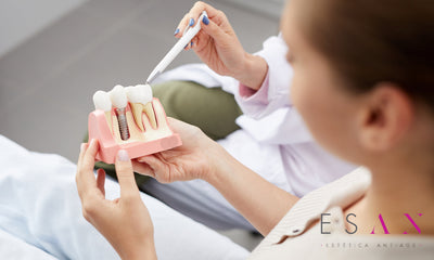 Implantes dentales: ¿Qué son y en qué consiste el tratamiento?