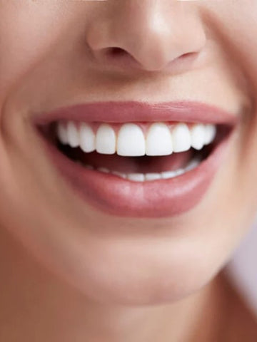 Blanqueamiento Dental Laser