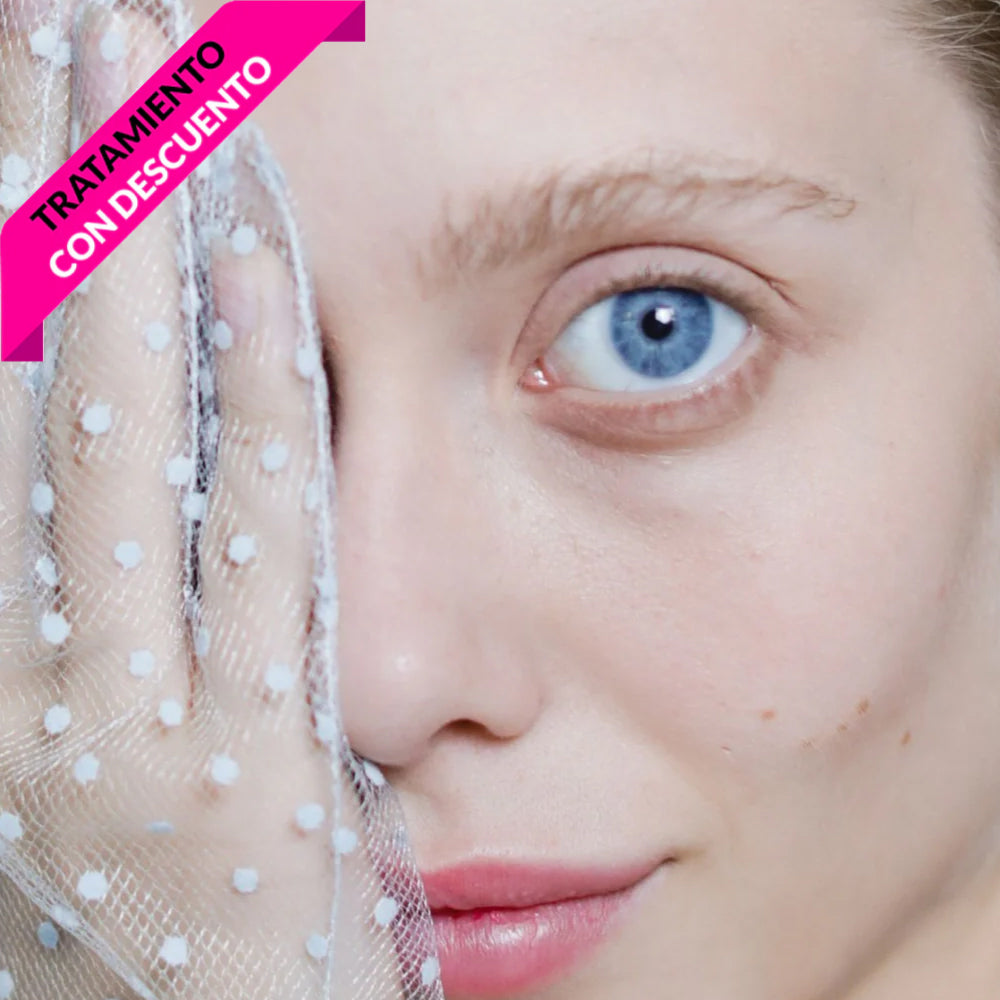 Aclaramiento de ojeras - Xela Rederm
