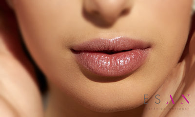 Relleno de labios