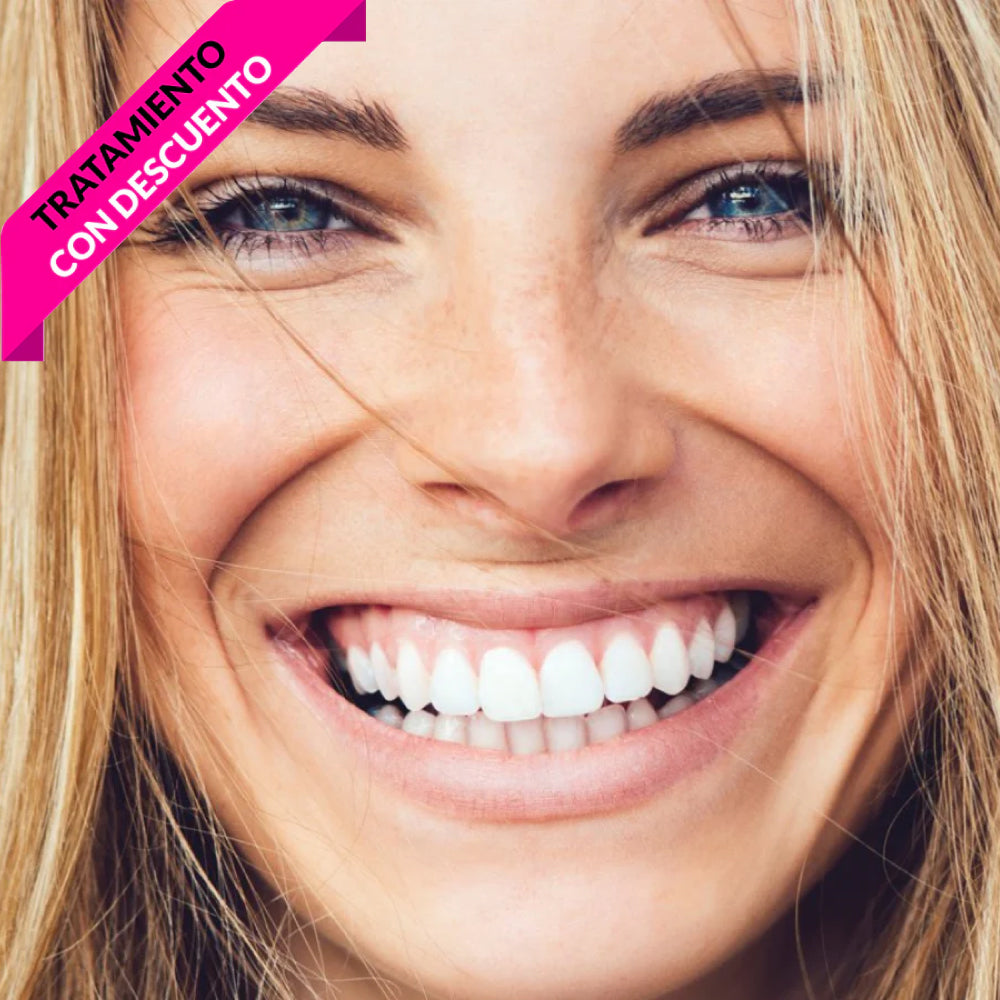 Limpieza dental + Rx bitewings