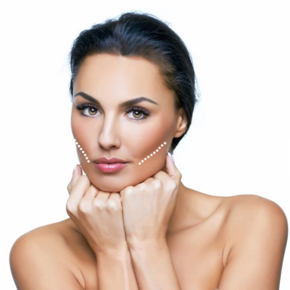 Bichectomia-clinicaesan-tratamiento-de-estetica-facial-1