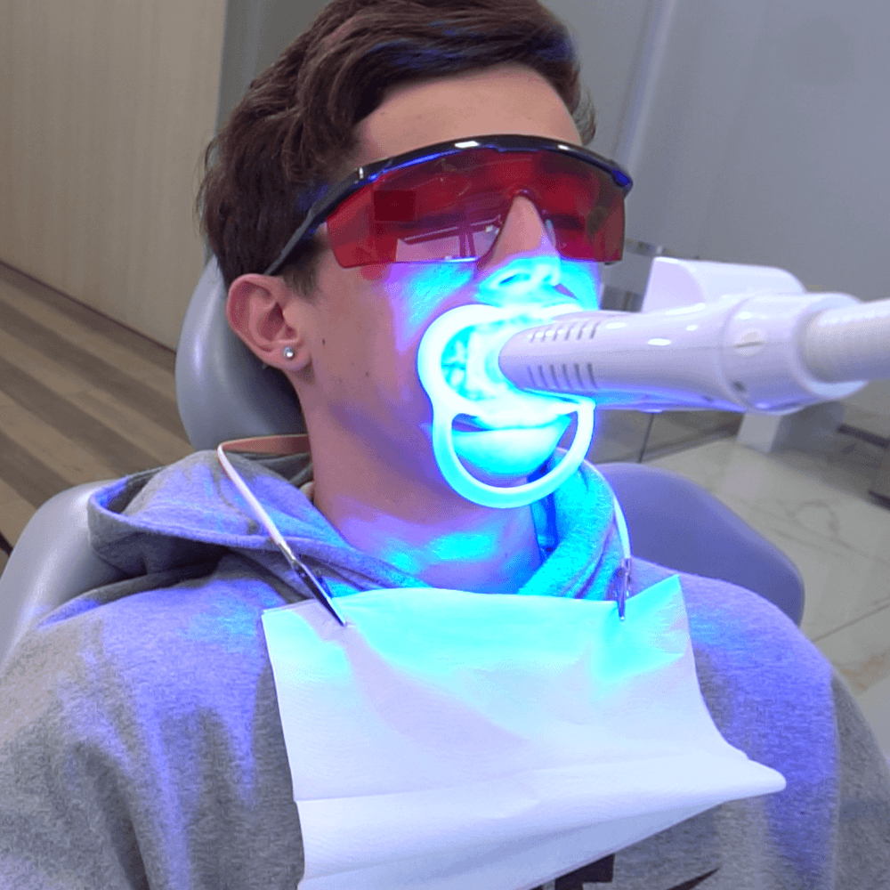 blanqueamiento-dental-laser-clinica-esan-dental-facial-2