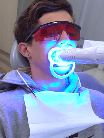 Blanqueamiento Dental Laser