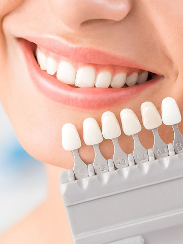 Blanqueamiento Dental en Casa