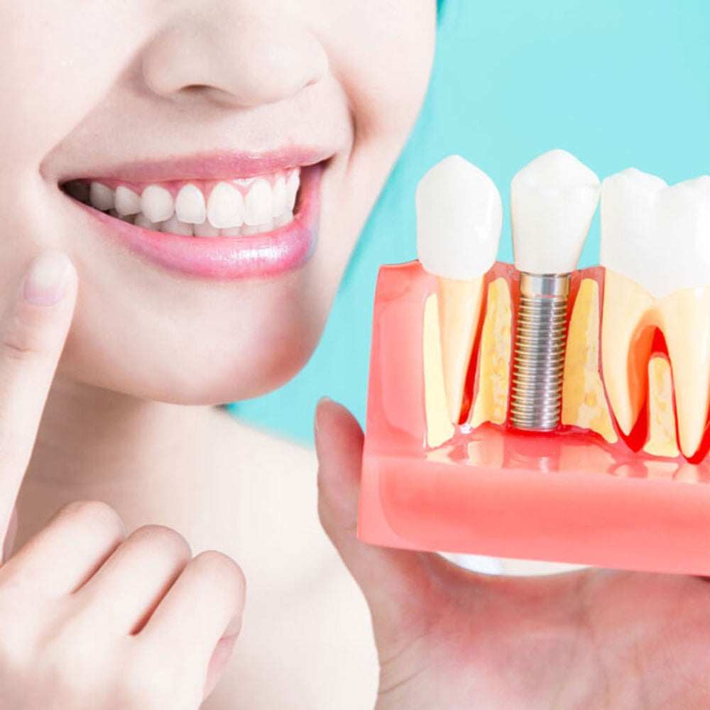 Implantología Oral