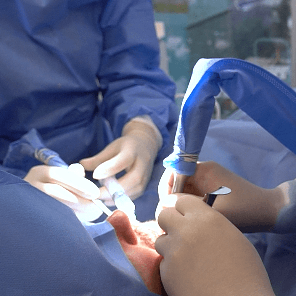 implantologia-oral-clinica-esan-odontologia-especializada-3