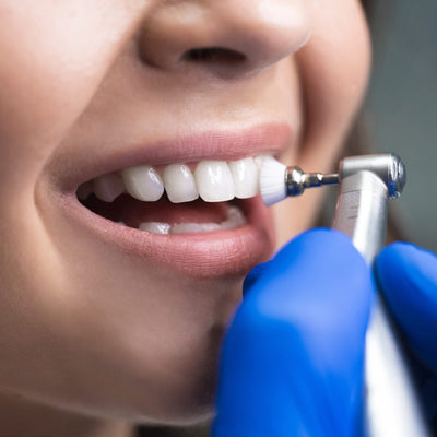 Limpieza dental + Rx bitewings
