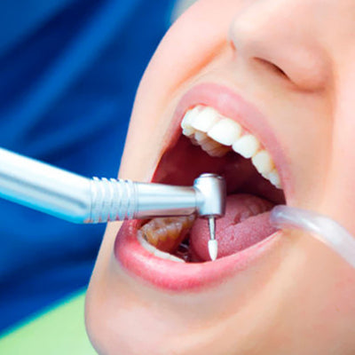 Endodoncia-tratamiento-de-conducto-clinica-esan-odontologia-especializada-3