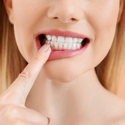 Periodoncia-tratamiento-de-encias-clinica-esan-odontologia-especializada-2