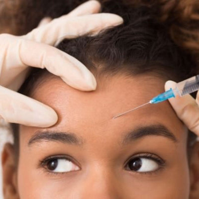 Toxina-Botulínica-3-zonas-clinica-esan-estetica-facial-2