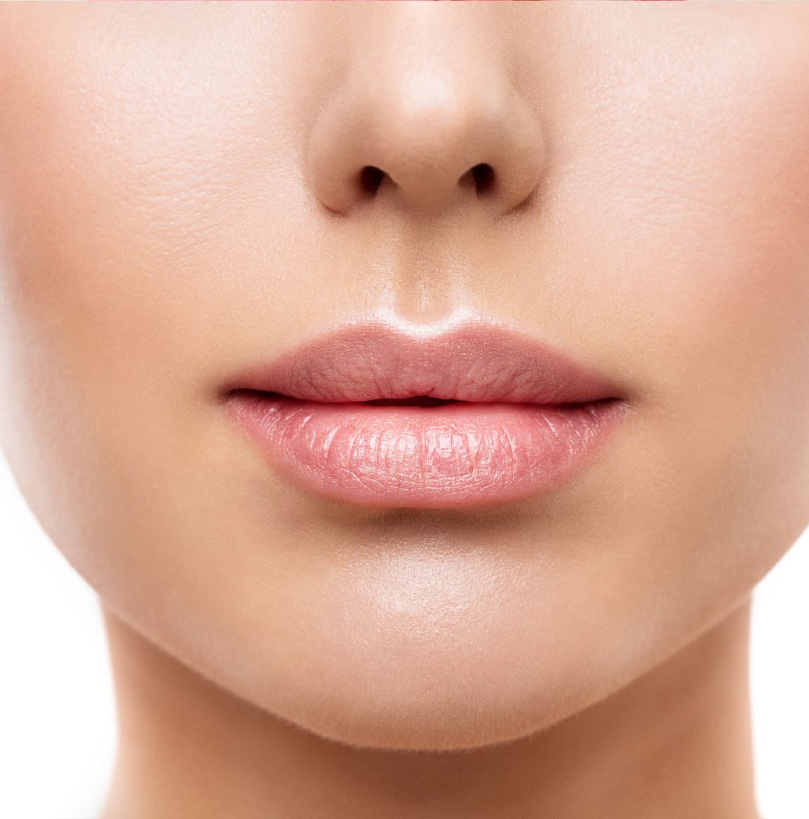 Lip Lift